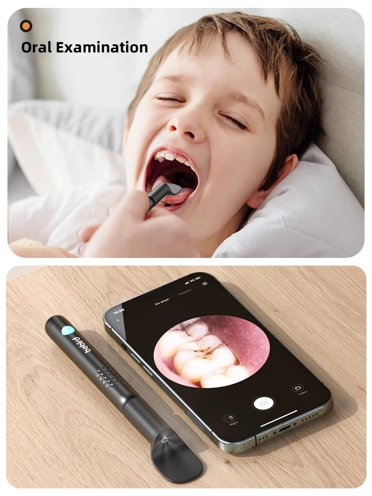 Bebird R3 เครื่องทําความสะอาดห - Pet Ear Cleaner บทวิจารณ์และราคา